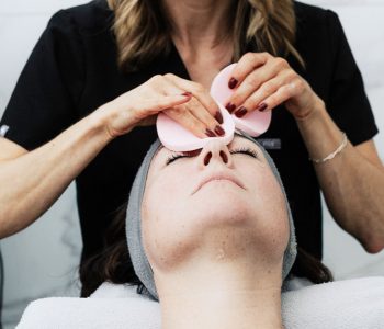 MiraBelle_Chemical-Peels-01