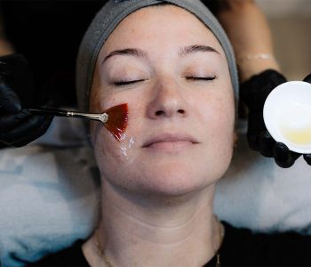 MiraBelle_Home-Popular_ChemicalPeels