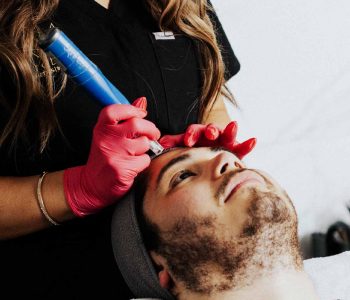 MiraBelle_Microneedling-03